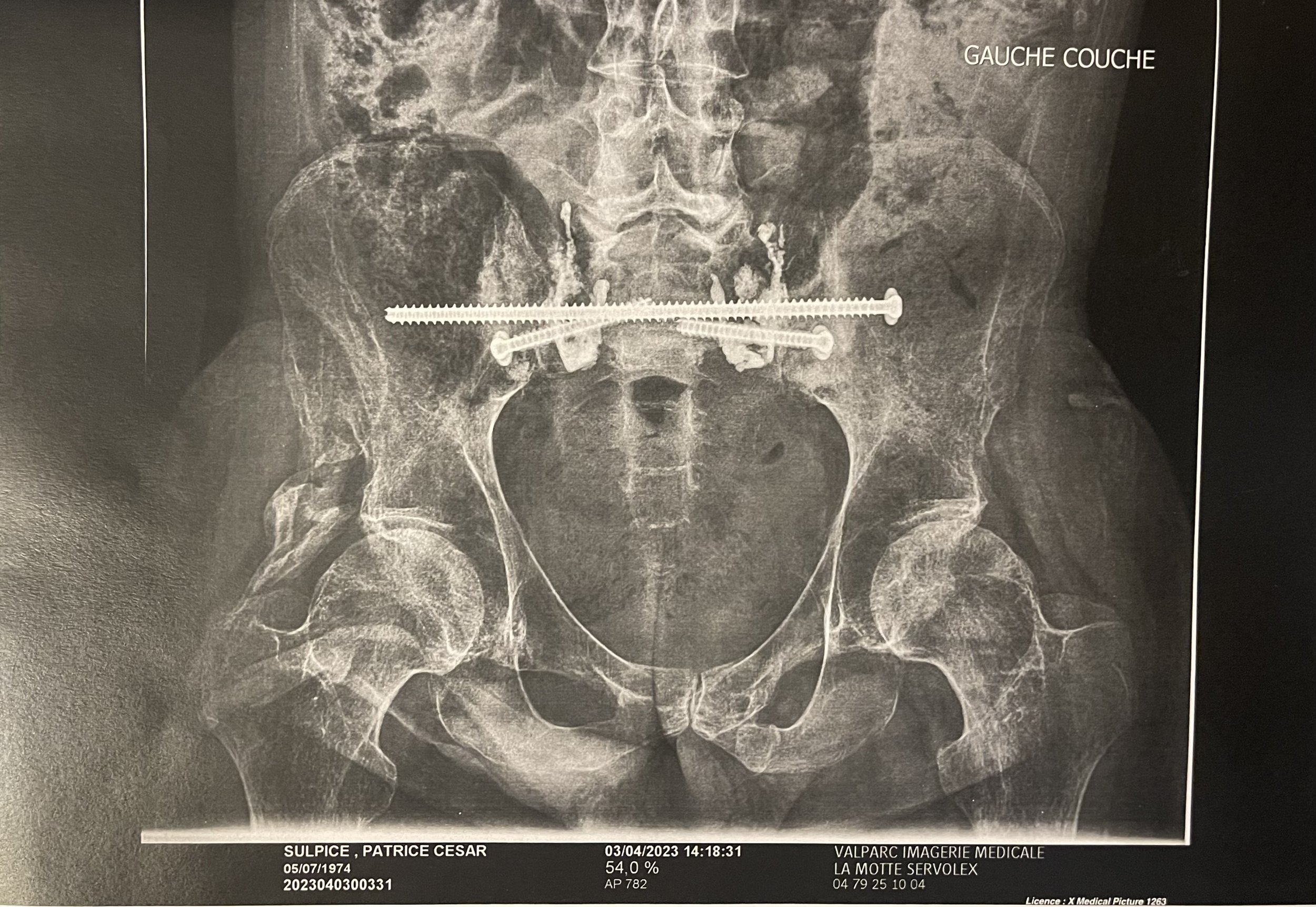 Retour à la réalité.