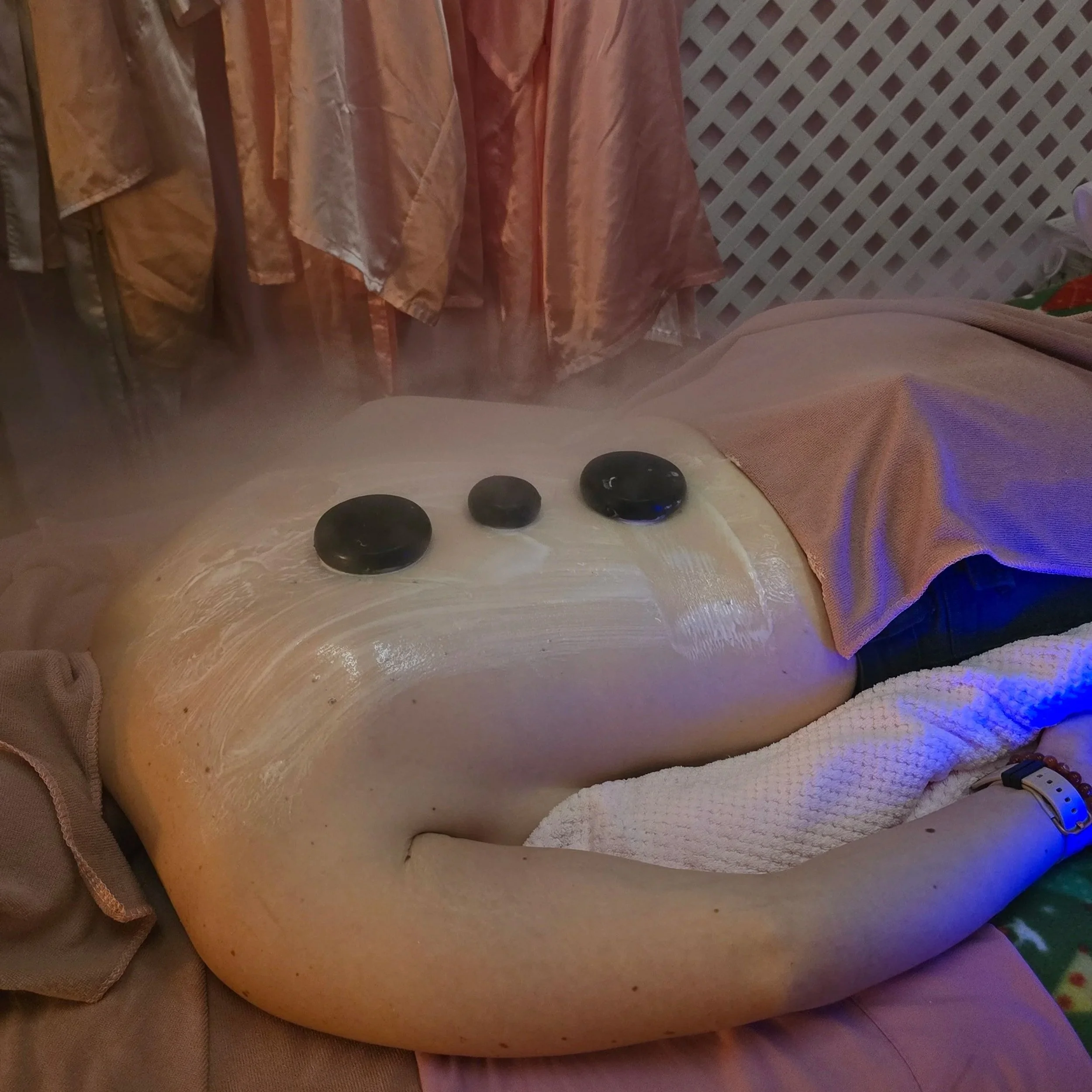 A person receiving a back facial, with three black hot stones placed on their back. The person is lying face down on a facial table, covered with a towel, with steam moving across the back.