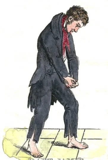 Gravure de Daft Jamie (James Wilson), victime de Burke and Hare, Édimbourg 1828
