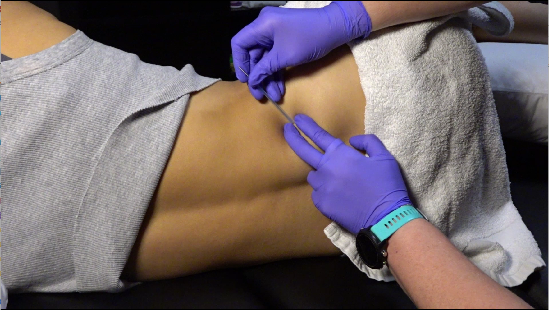 Master Class: Clinical Application for Dry Needling