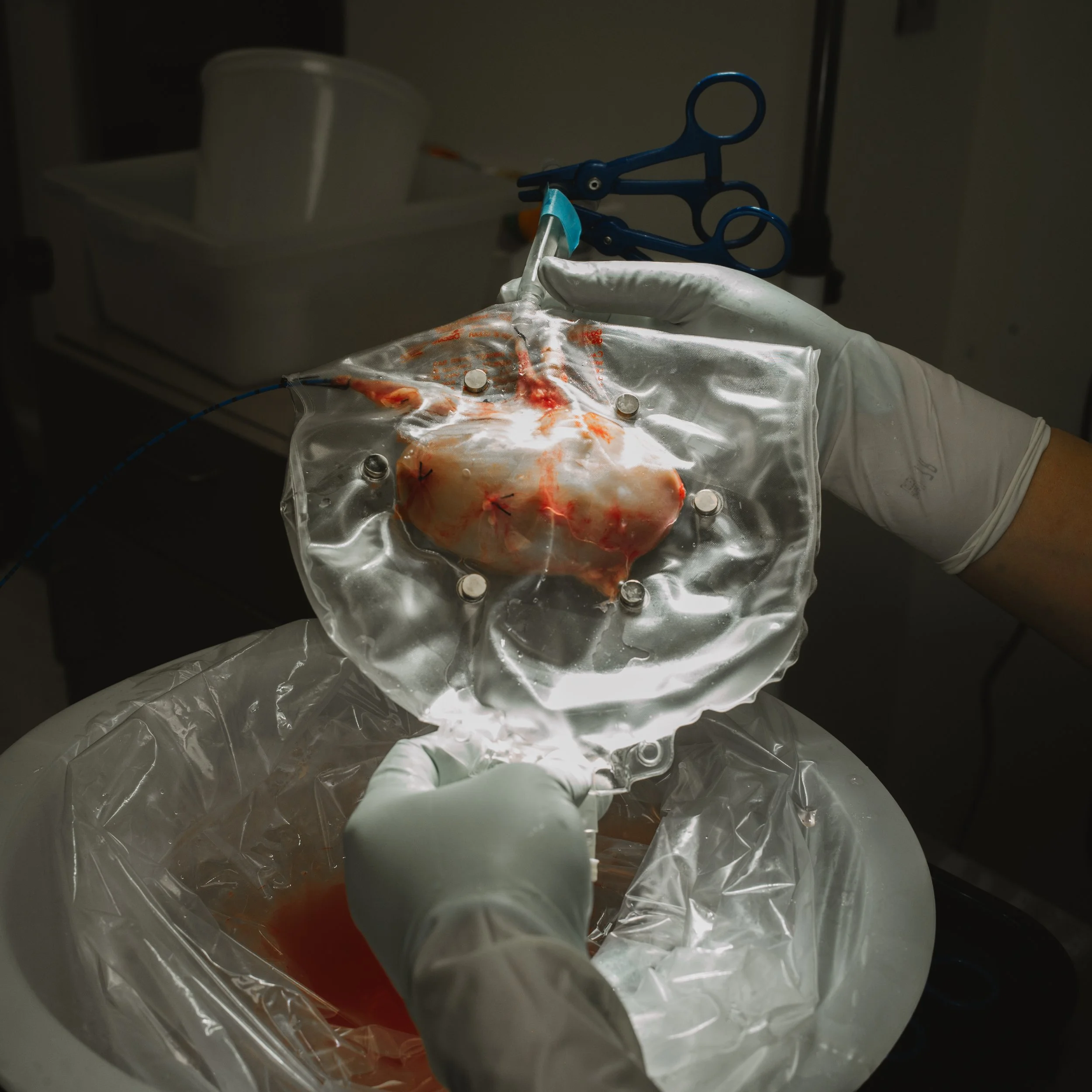 A scientist in gloves handling a transparent plastic package with a human heart inside, connected to medical tubing.