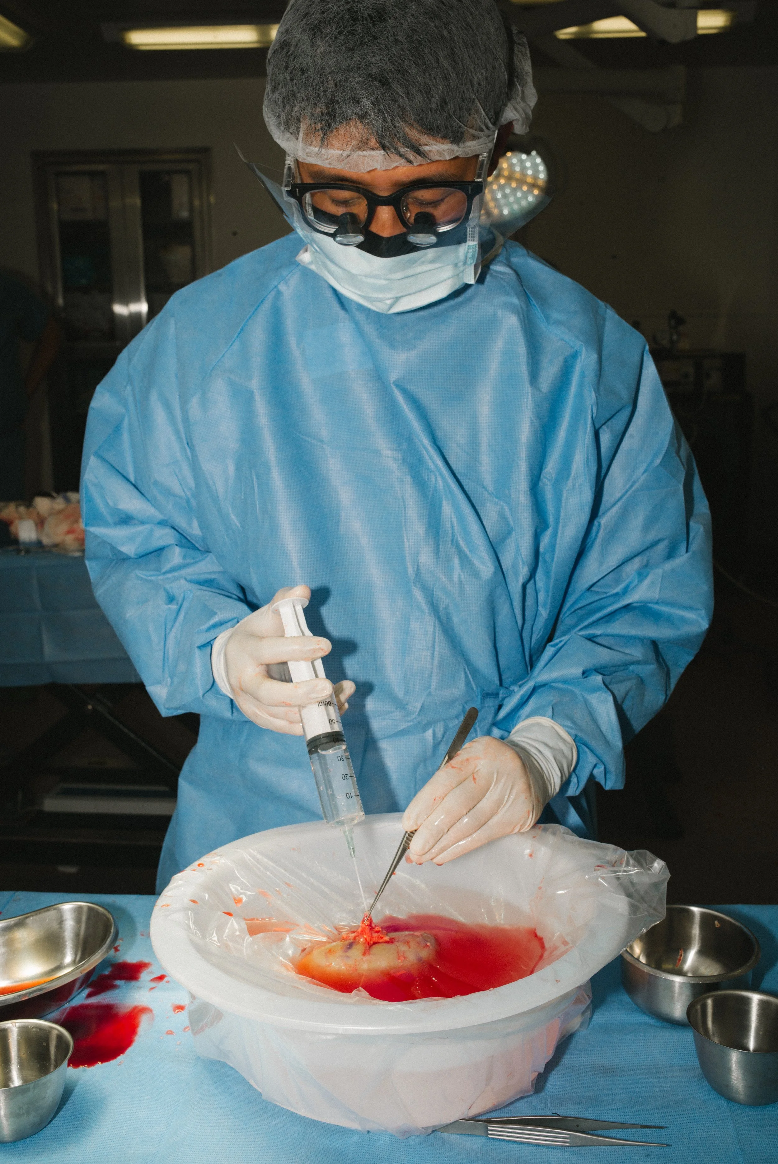 A person dressed in surgical scrubs, mask, and gloves is performing a surgical procedure on a transparent organ or tissue inside a container, with various surgical tools and containers nearby.