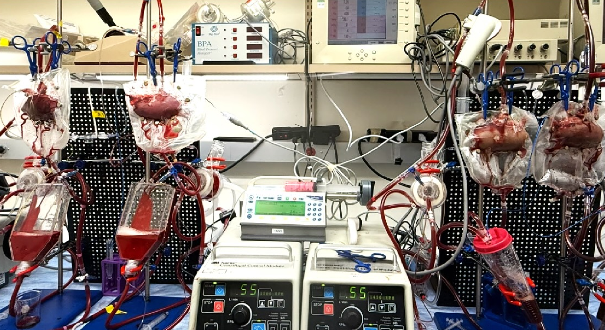 Medical laboratory setup with blood bags, tubing, and dialysis machines in a hospital or lab setting.