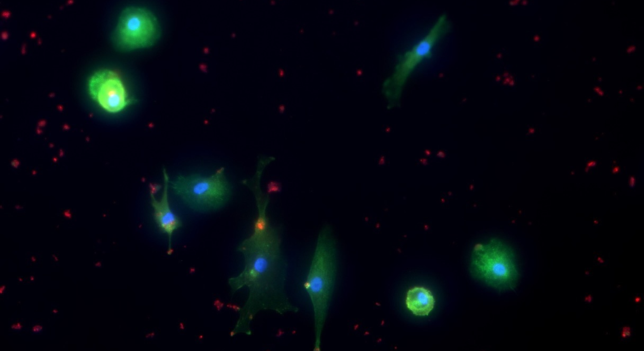 Microscopic view of glowing green and blue cells with red dots in the background.
