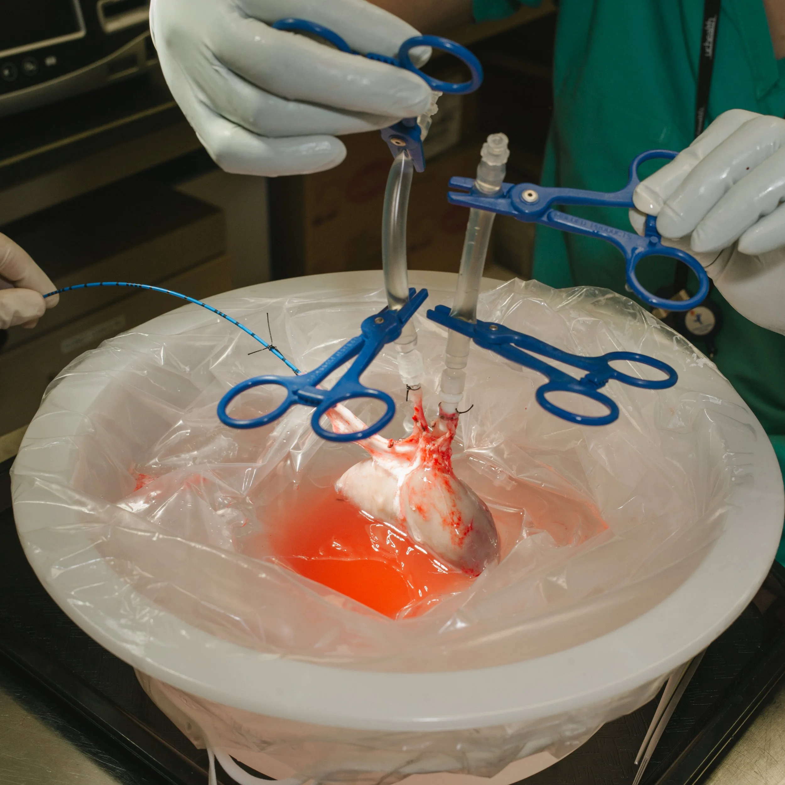 Medical team performing a cardiovascular procedure with a human heart, connected to tubes and surgical tools, inside a sterile environment.