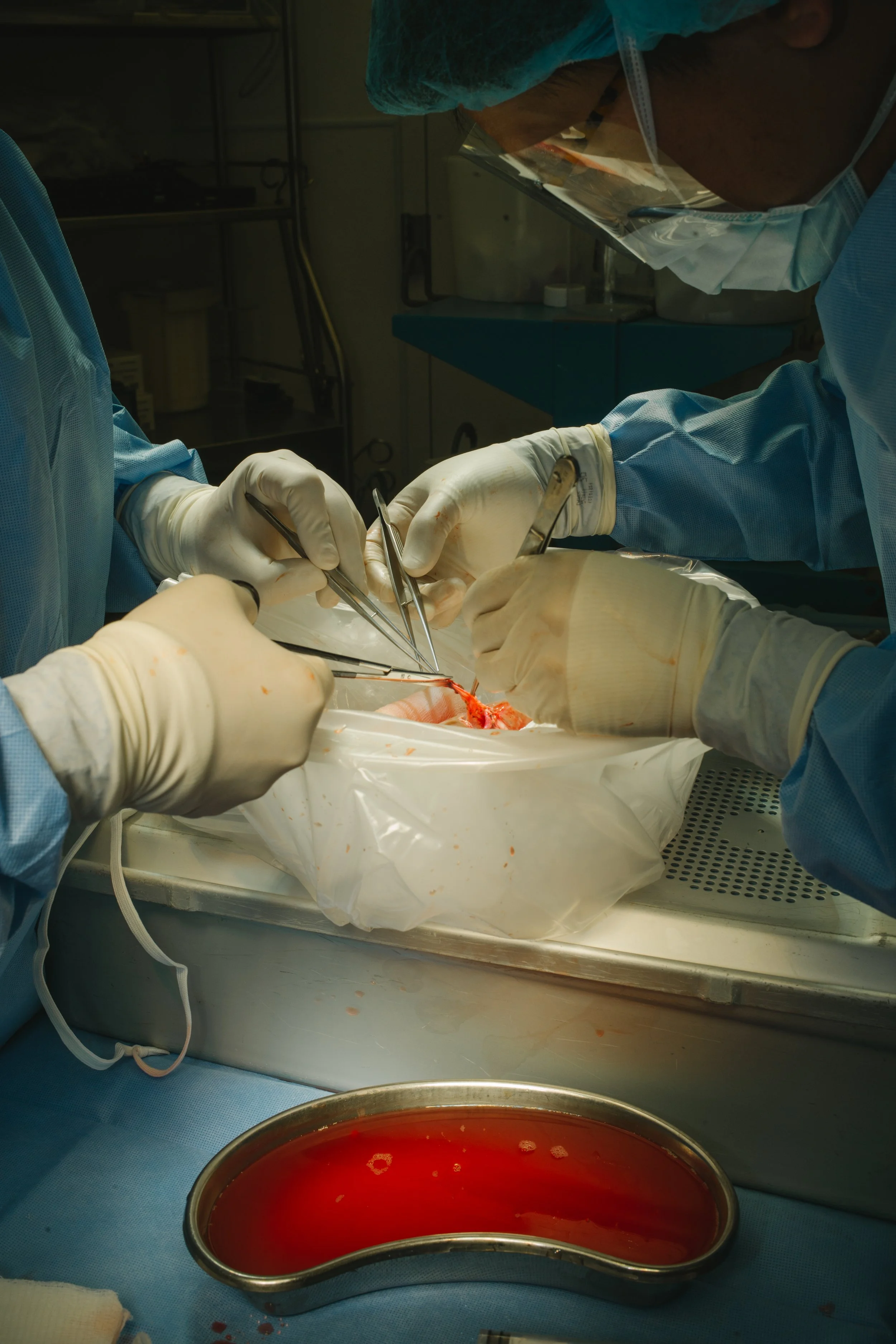 Surgeons performing an operation in an operating room, surrounded by medical tools and sterile materials.