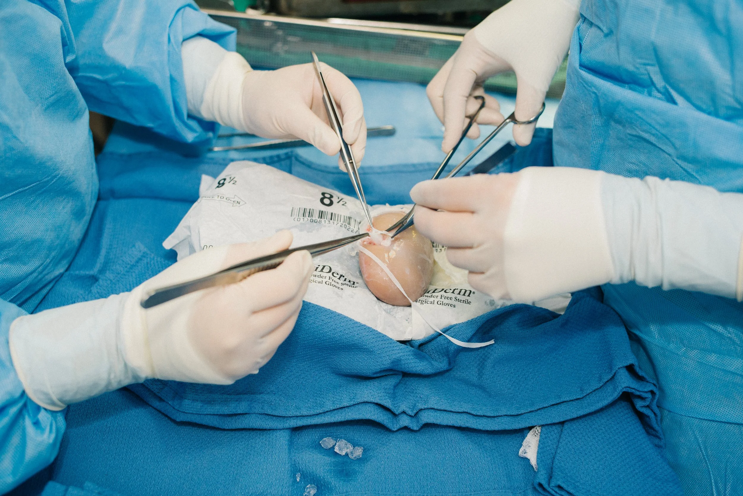 Surgeons in blue scrubs performing surgery on a human organ, using surgical instruments in an operating room.
