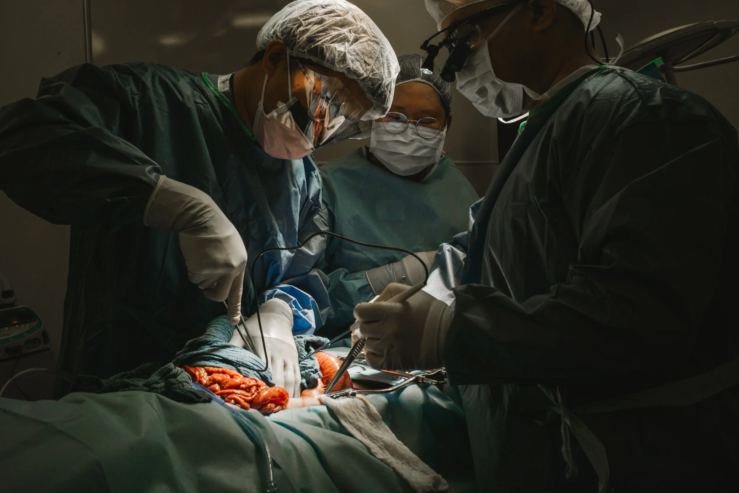 Medical team performing surgery in an operating room, with surgeons wearing surgical masks, gowns, and gloves, focused on the procedure.