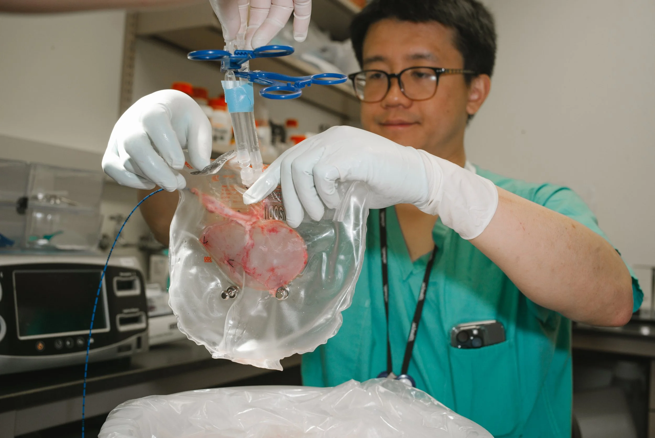 A scientist in a lab, wearing white gloves, handling a transparent organ explant inside a sealed plastic bag.