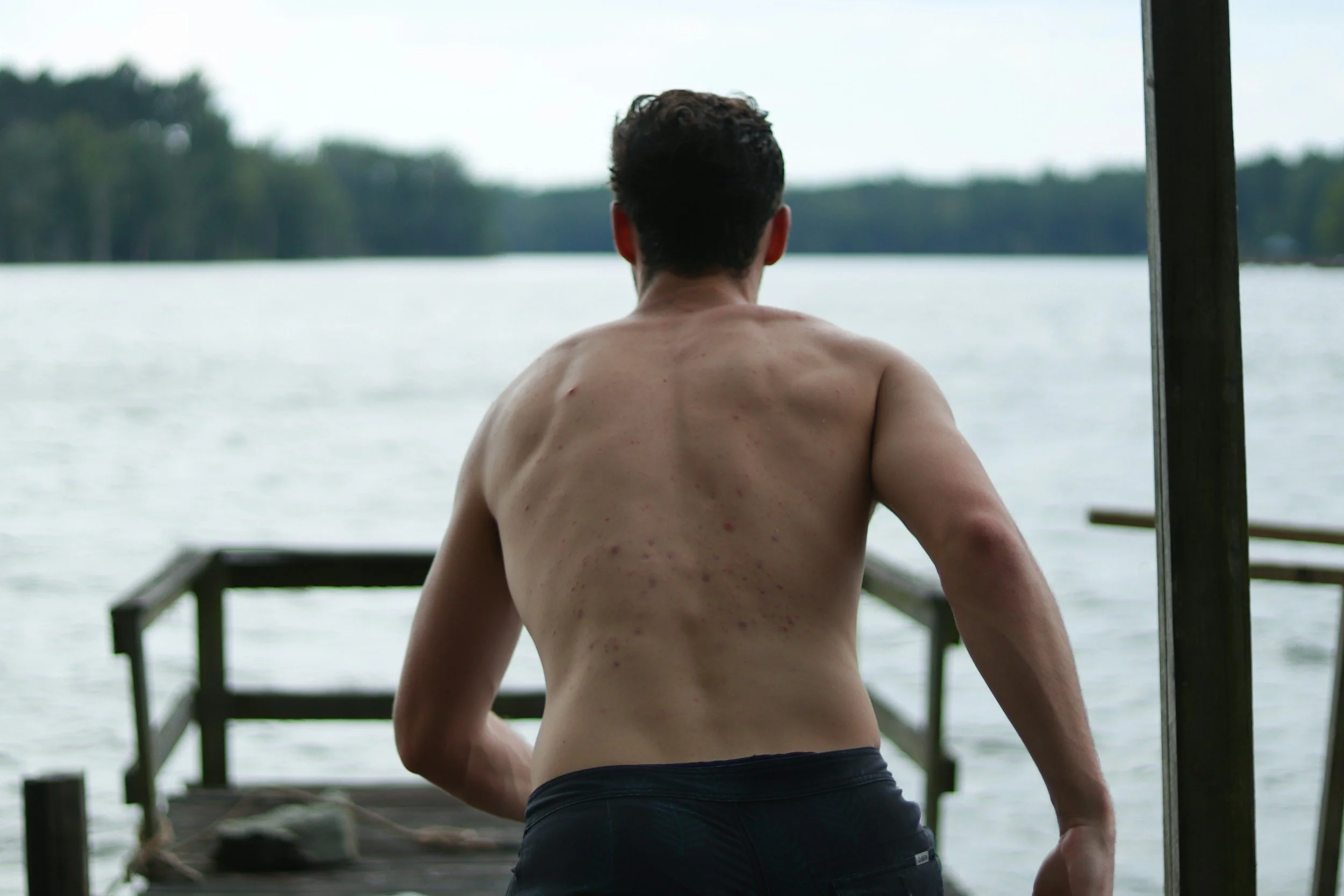 A shirtless man standing on a dock by a lake, facing away from the camera, with trees in the background.