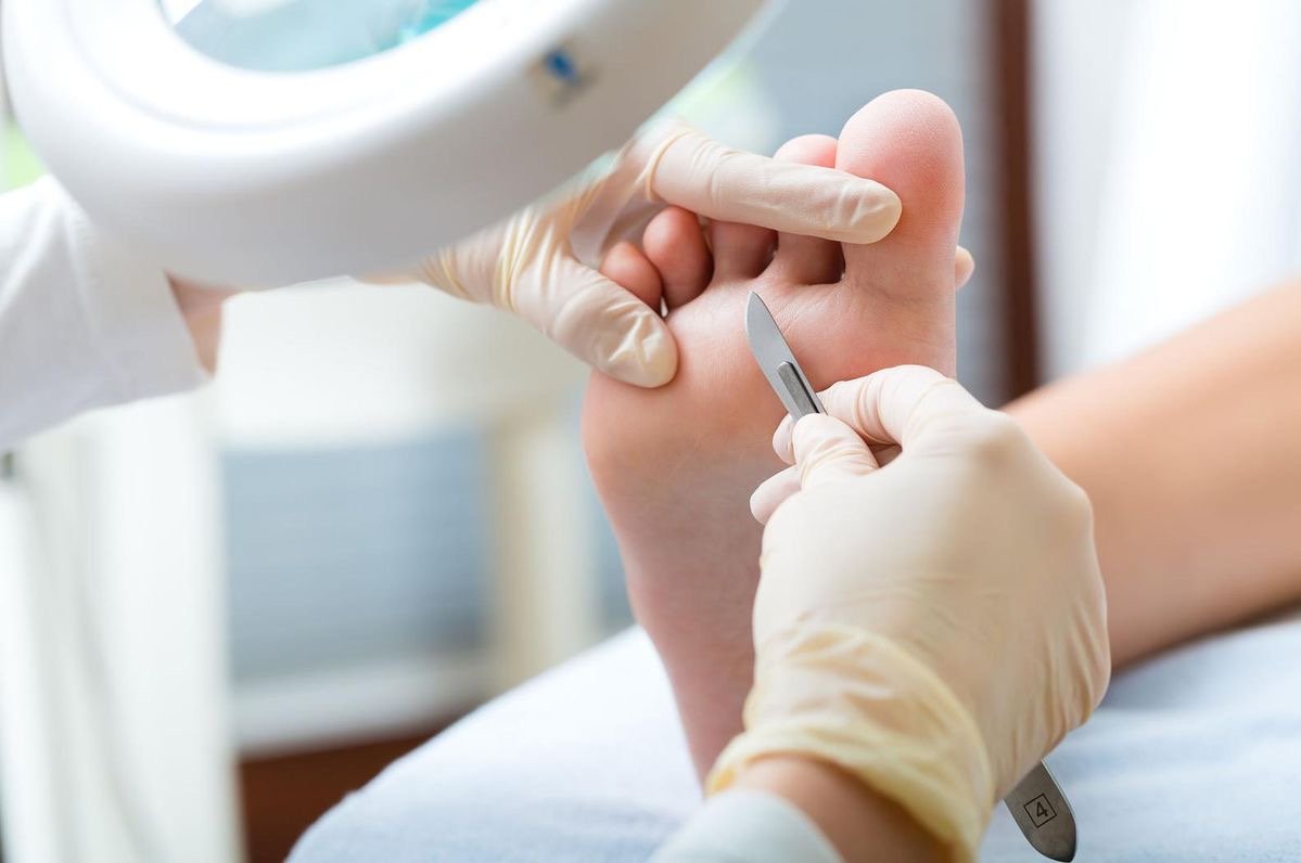 A healthcare professional in gloves is using a small metal tool to perform a podiatry procedure on a person's foot.