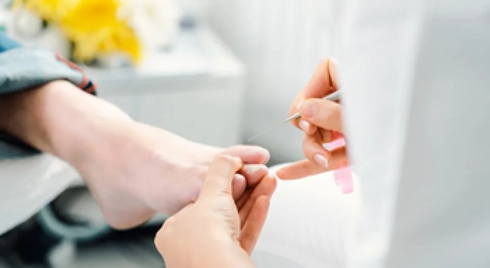 Patient receiving a nail treatment.