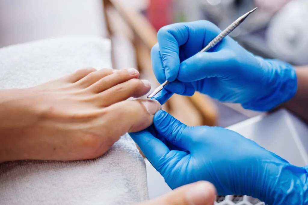 Close-up of a person with a tan skin tone receiving a medical treatment. A professional wearing blue gloves is using a metallic instrument on the person's foot.