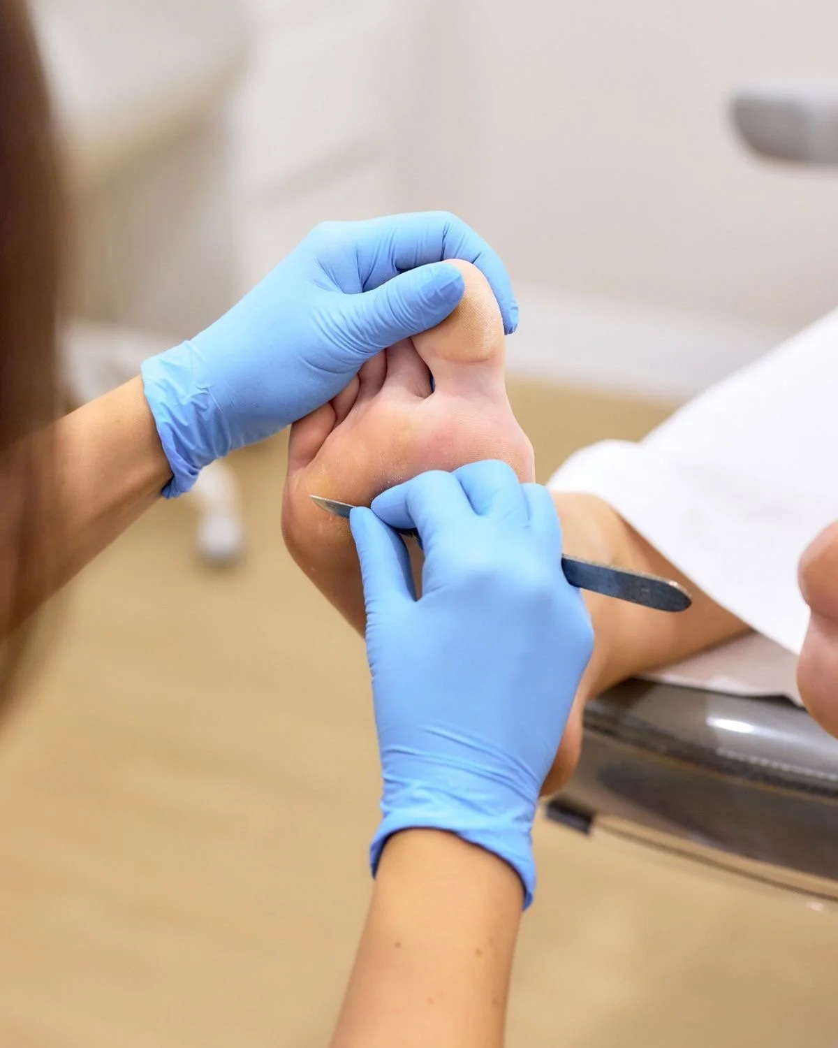 A medical professional wearing blue gloves is cutting a patient's toenail with a nail clipper. The patient’s foot is resting on a metal surface, and the background is out of focus.
