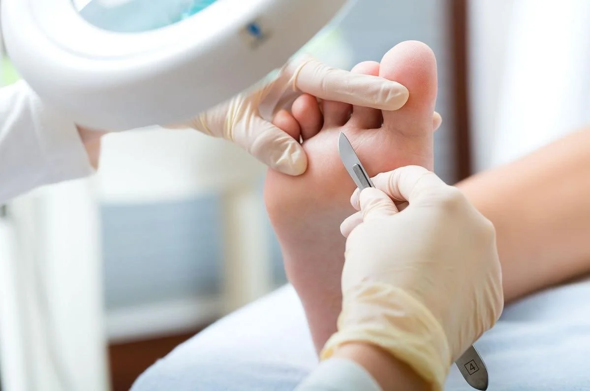 A healthcare professional in gloves is using a small metal tool to perform a podiatry procedure on a person's foot.