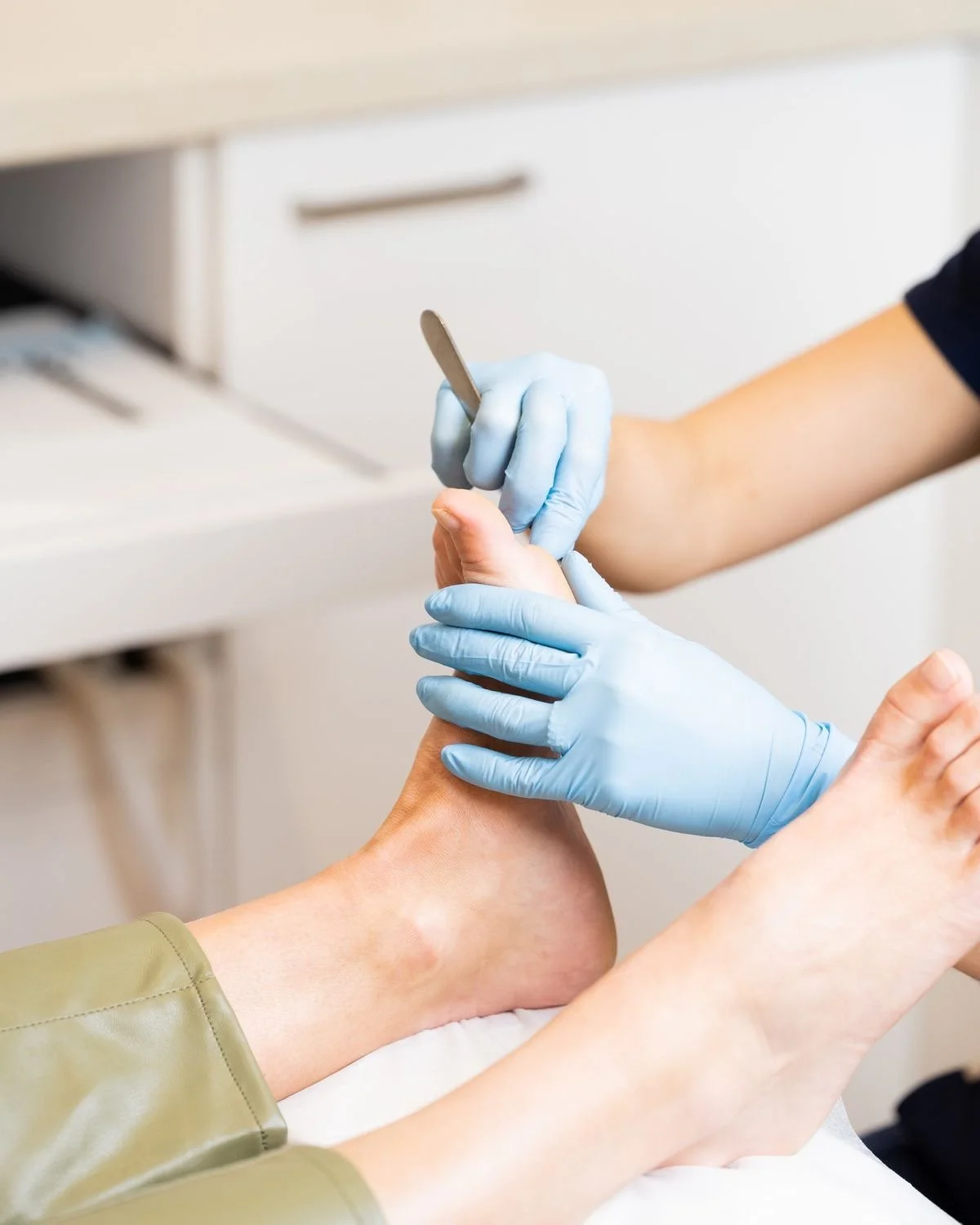 Person wearing blue gloves uses a tool to examine or treat a patient's foot in a clinical setting.