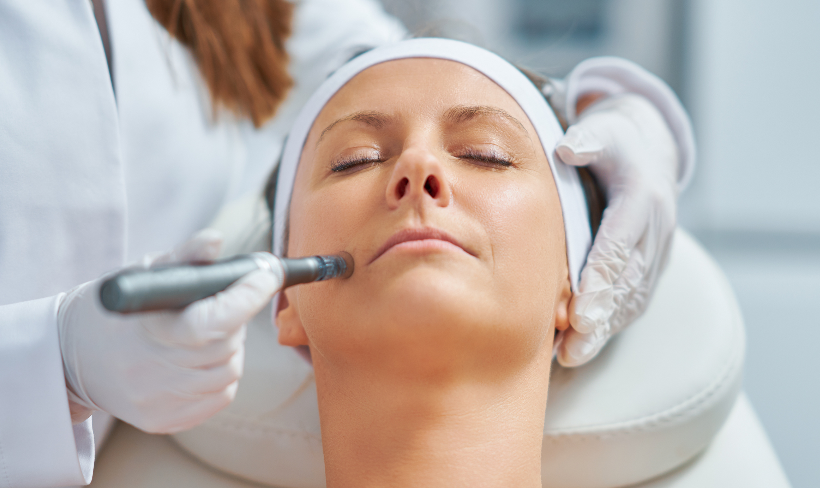 Medspa in Turlock, CA, 95380  Microneedling Near Me.png