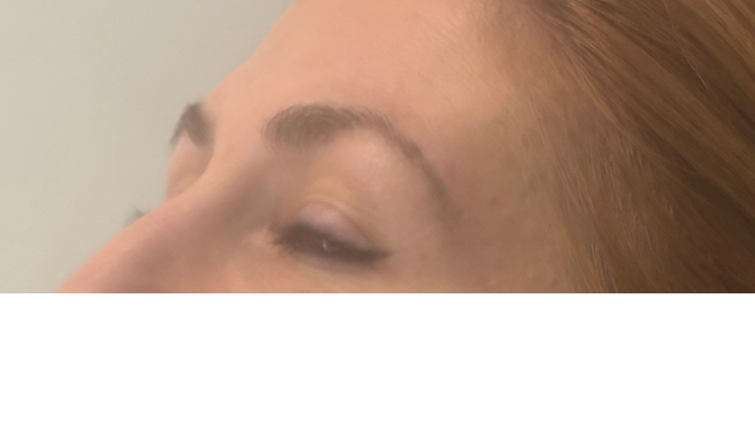 Before combination brows