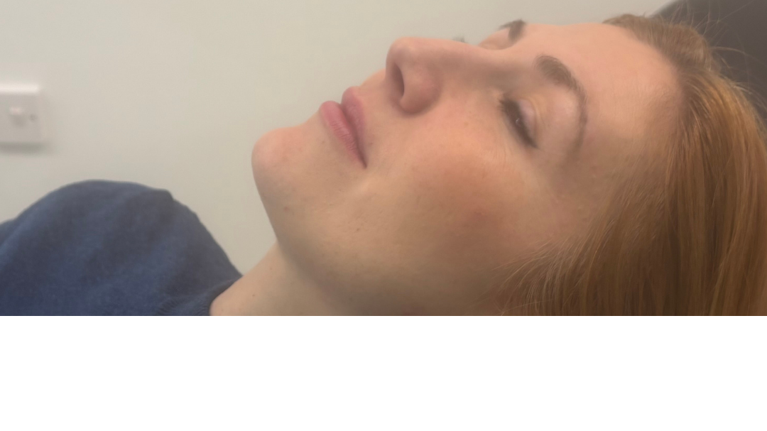 Before combination brows and full lip blush