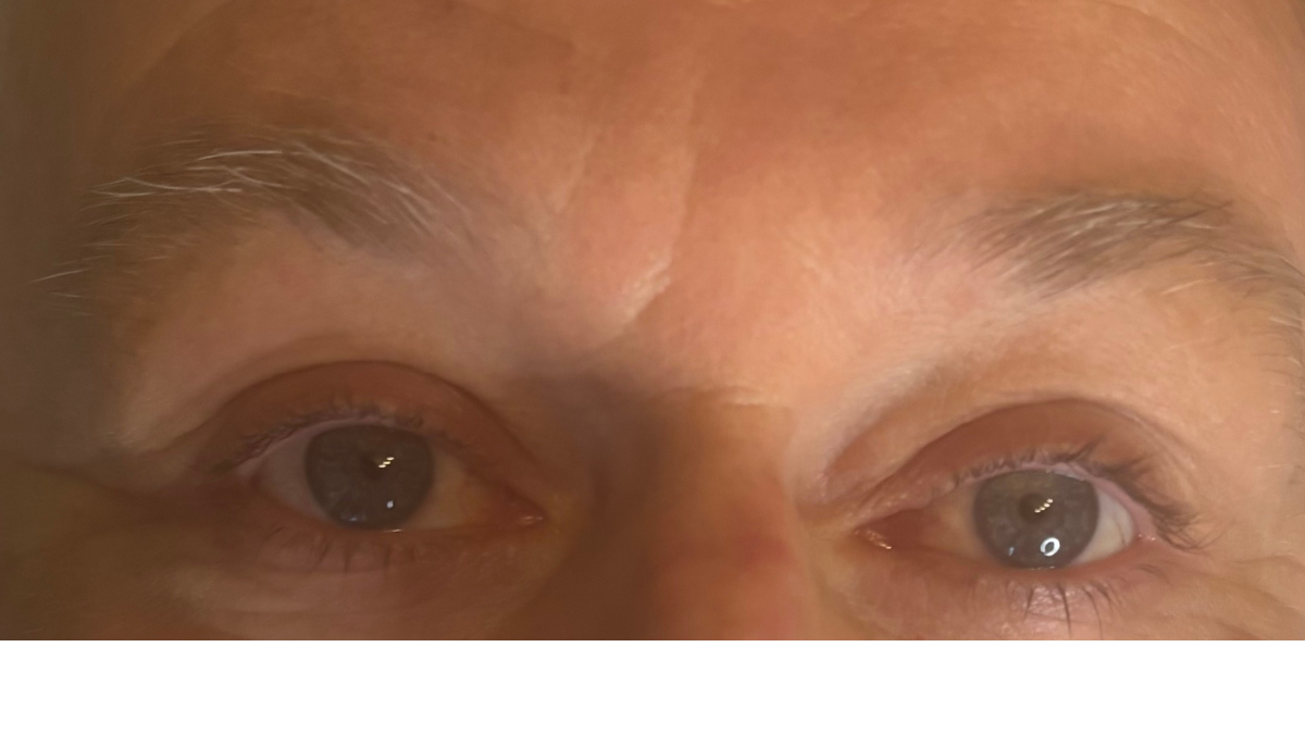 Before: Naturally sparse brows with minimal density. This client wanted subtle definition while keeping the result soft and realistic.