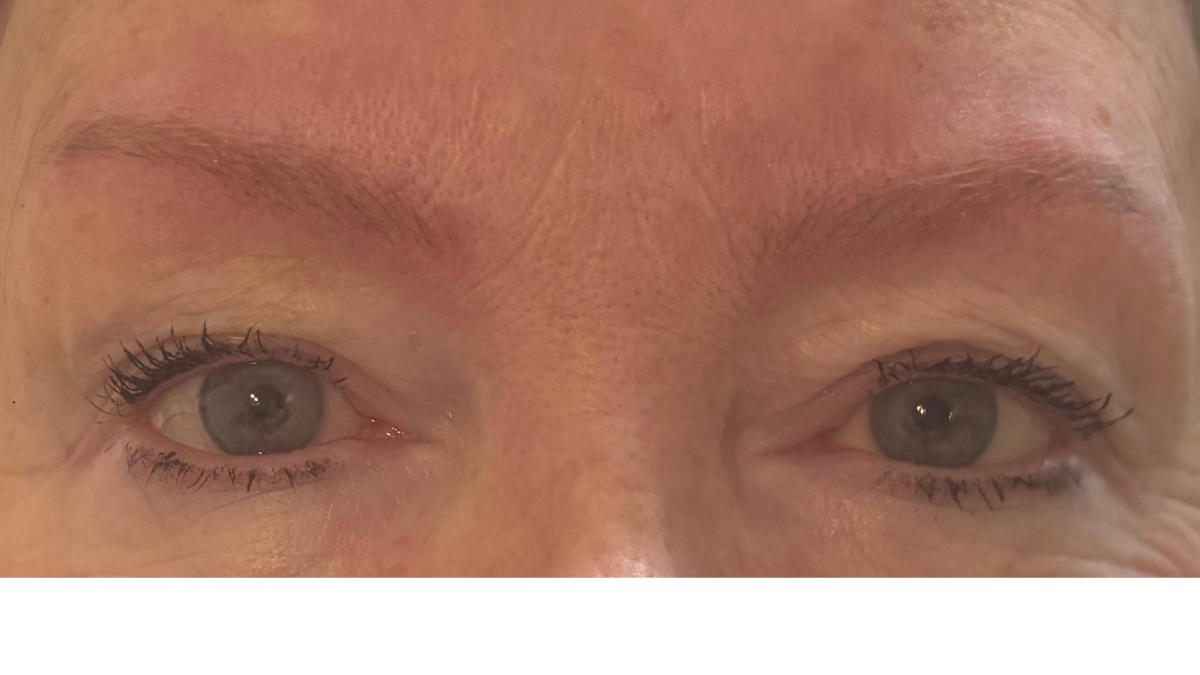 Immediately after natural hair strokes for client with thyroid and cancer-treatment related hair loss. 
