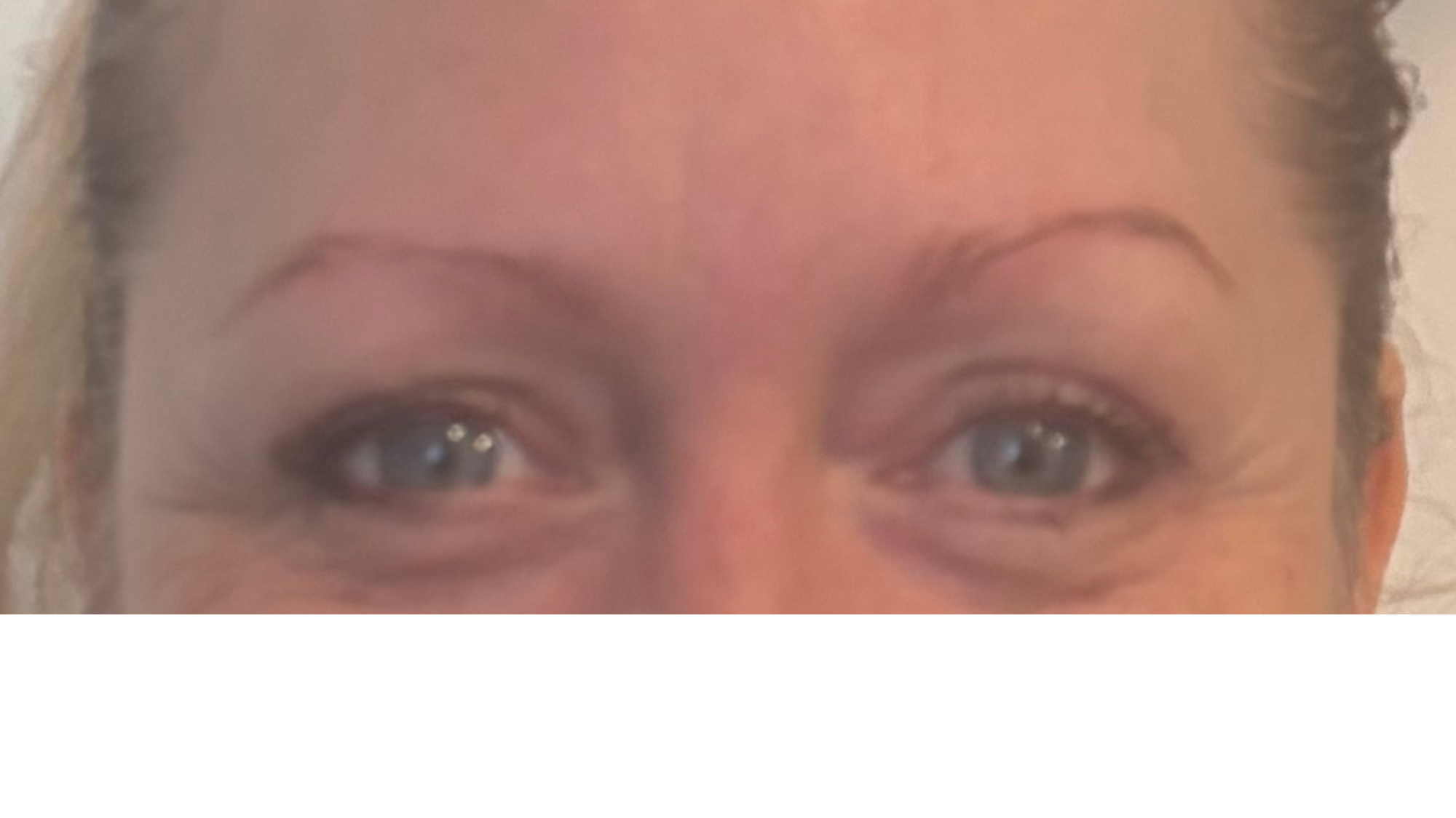 Before natural hairstroke brow restoration for a client experiencing hair thinning post cancer treatment.