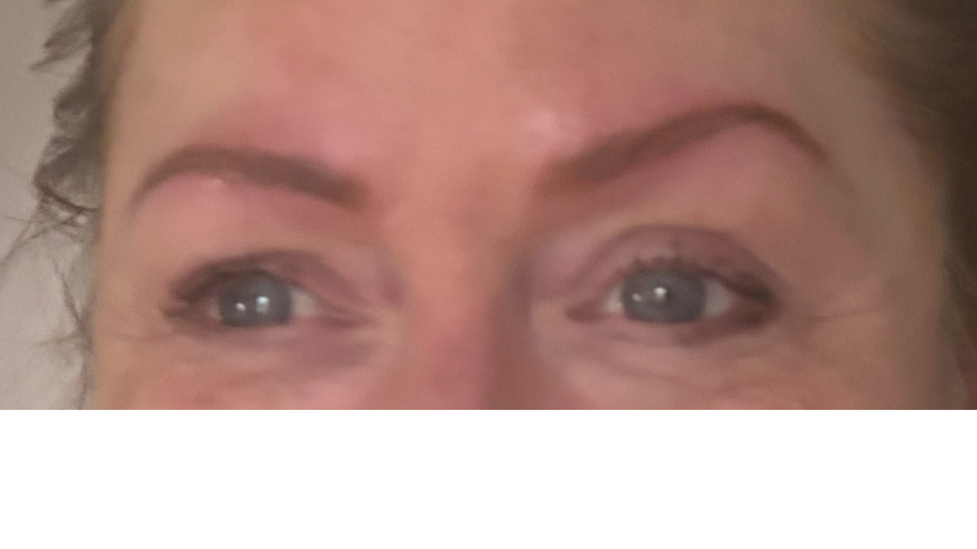 Immediately after natural hairstroke brow restoration, designed to restore shape and definition while maintaining a soft, natural appearance.