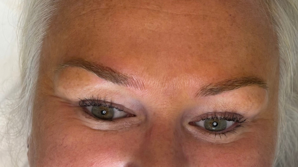 Combination eyebrow restoration-bringing balance and definition to frame the eyes.