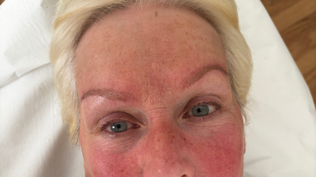 Structure and definition restored with bespoke permanent makeup.