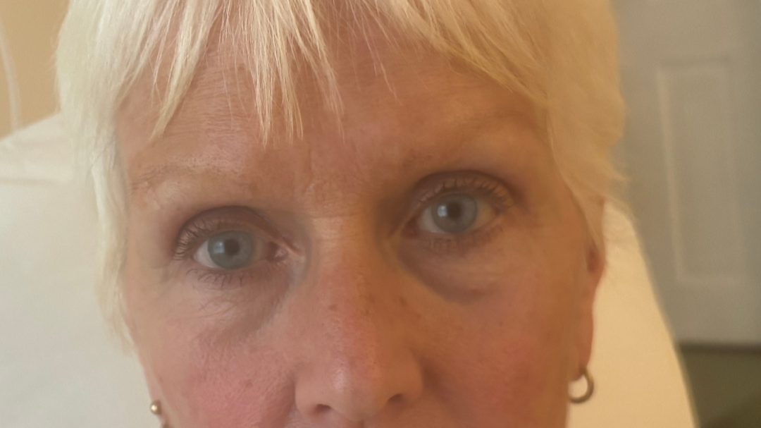 Sparse and faded brows.