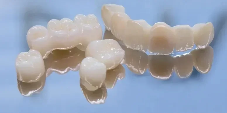 photo of dental bridges and crowns