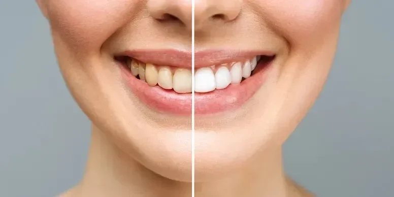 Picture of a woman's smile.