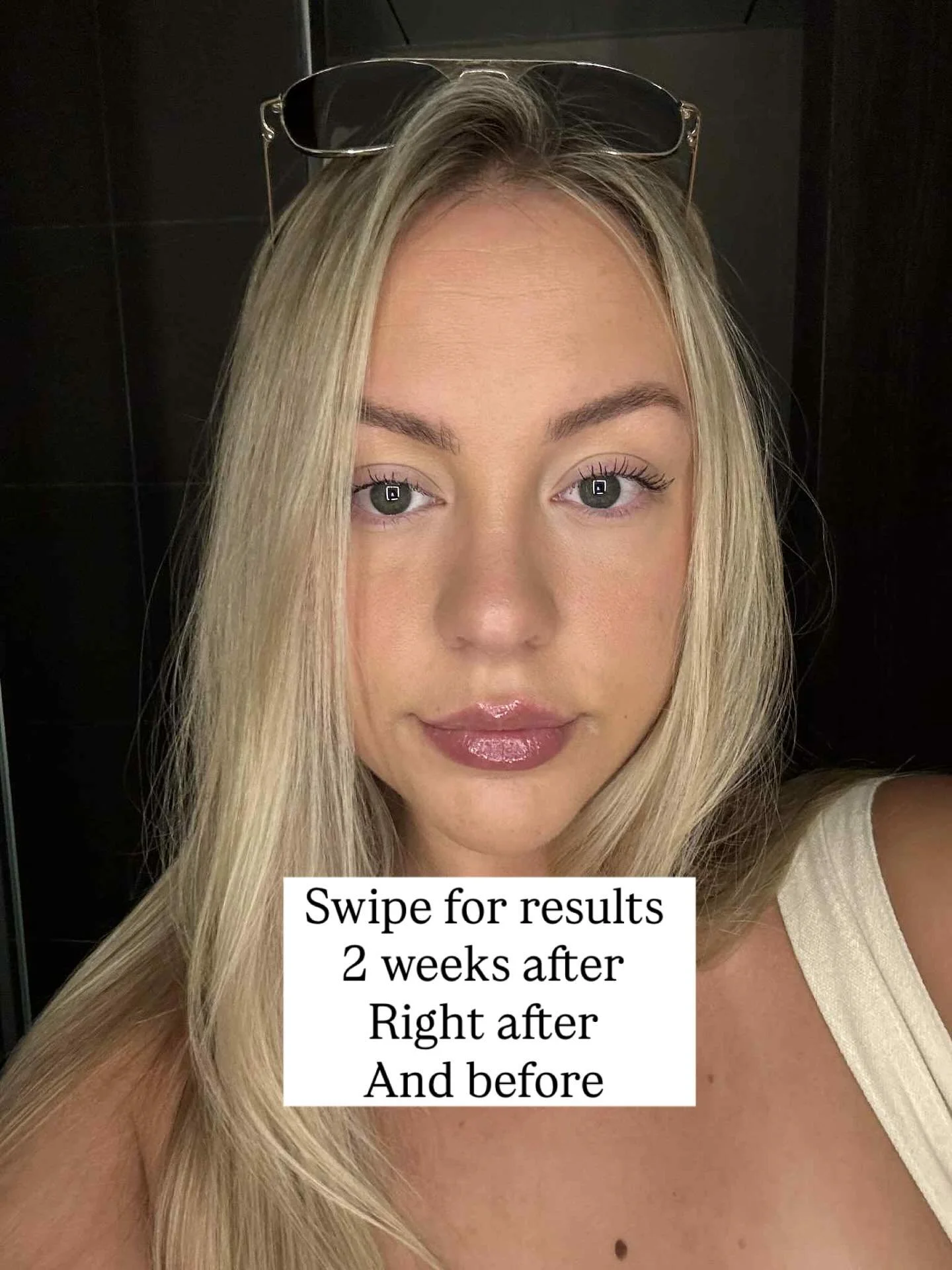 ✨ 2-Week Lip Blush Results ✨
 looking stunning after 2 weeks! 💋 The color has beautifully softened into a natural tone 
✔️ Long-lasting pigment
✔️ Enhanced natural beauty  Lip blushing amplifies your lip shape and gives you a lasting wash of color. 