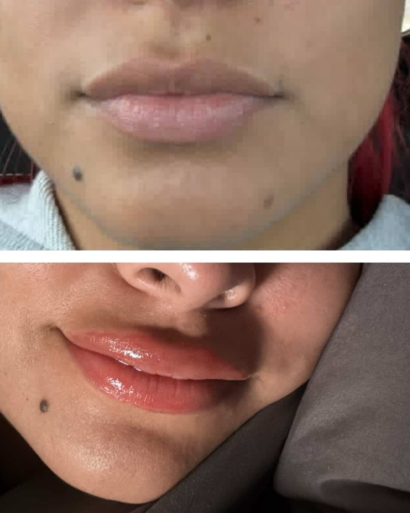 ✨ Lip Neutralization Explained ✨
Did you know not everyone can achieve the same lip blush shade right away? 💋

For clients with naturally darker, cool, or uneven tones in their lips, lip neutralization is the first step. This process uses carefully 