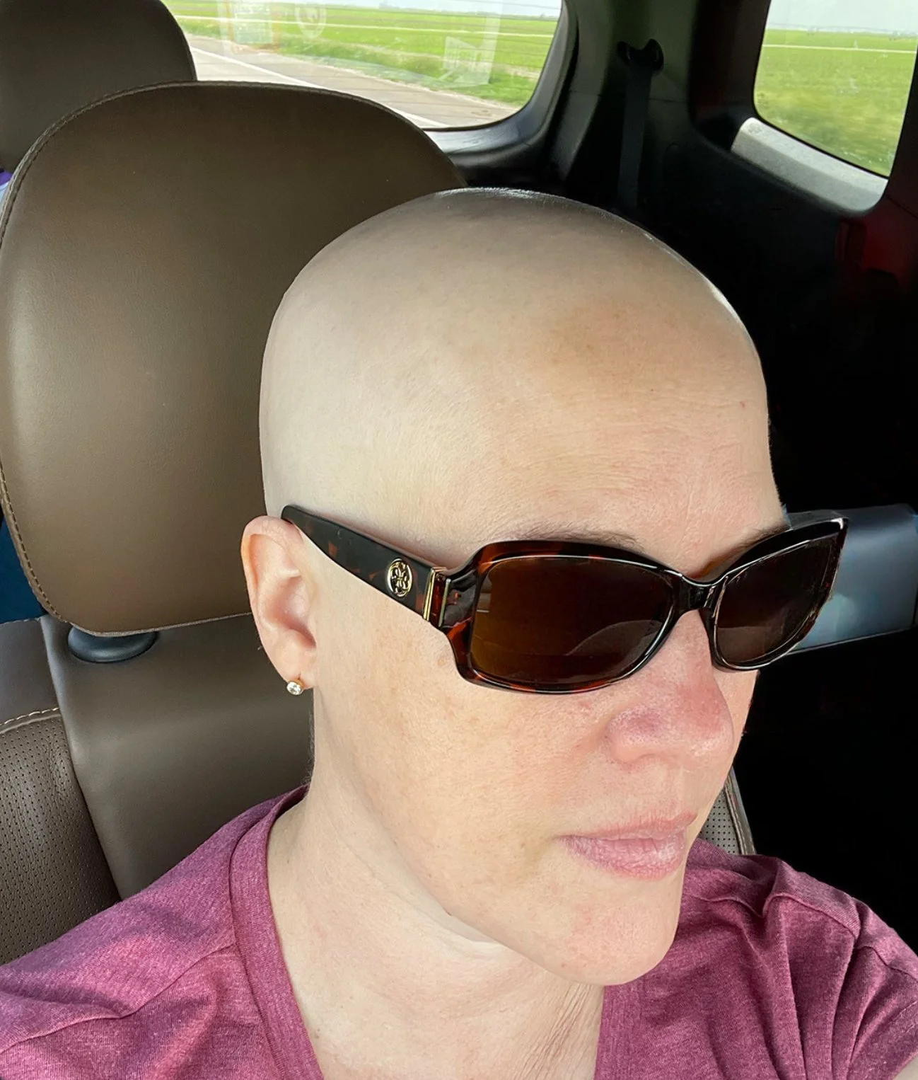 Melissa Albers, psychiatric nurse practitioner, during cancer treatment.