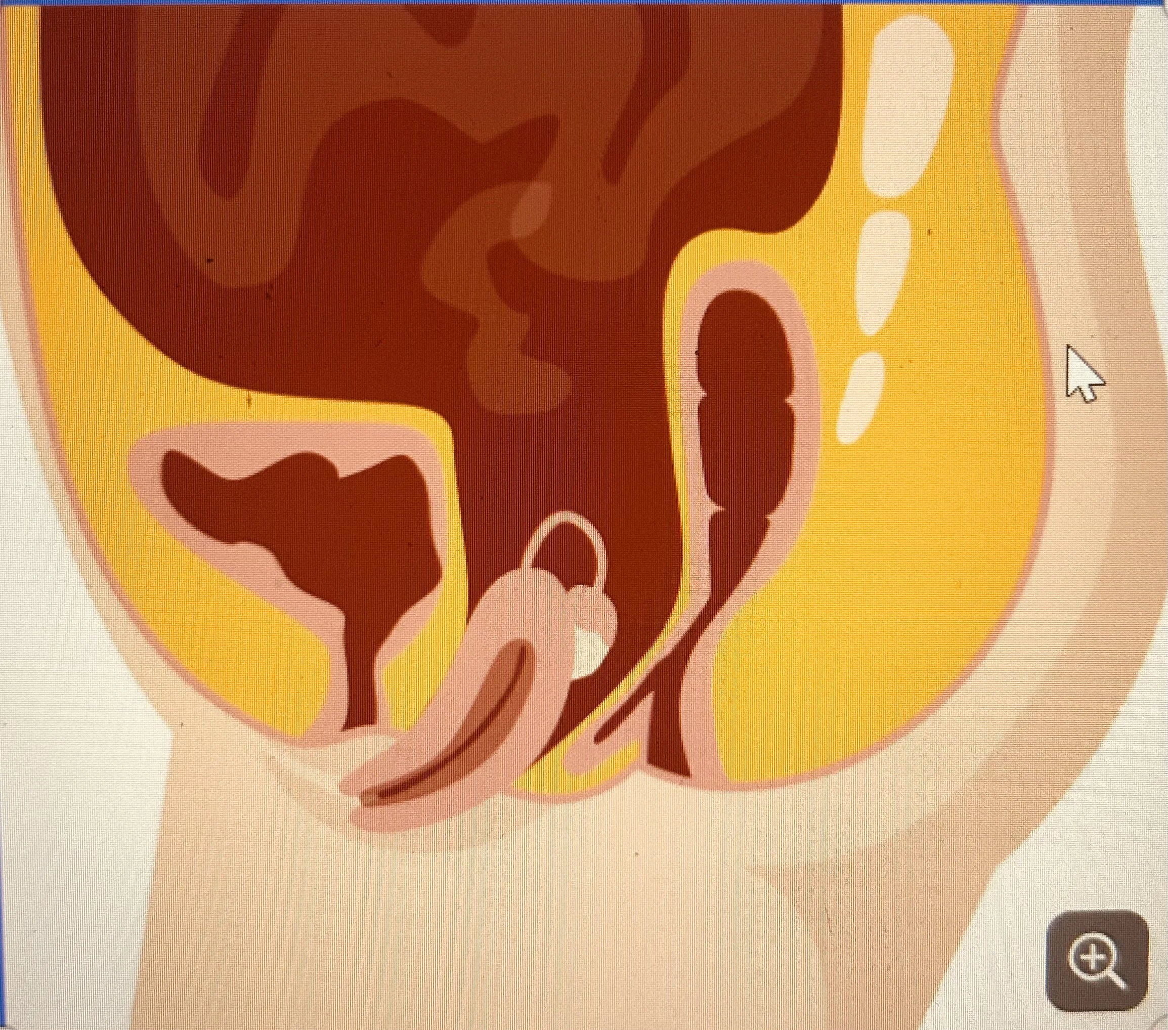 Pelvic Floor Therapy and Prolapse