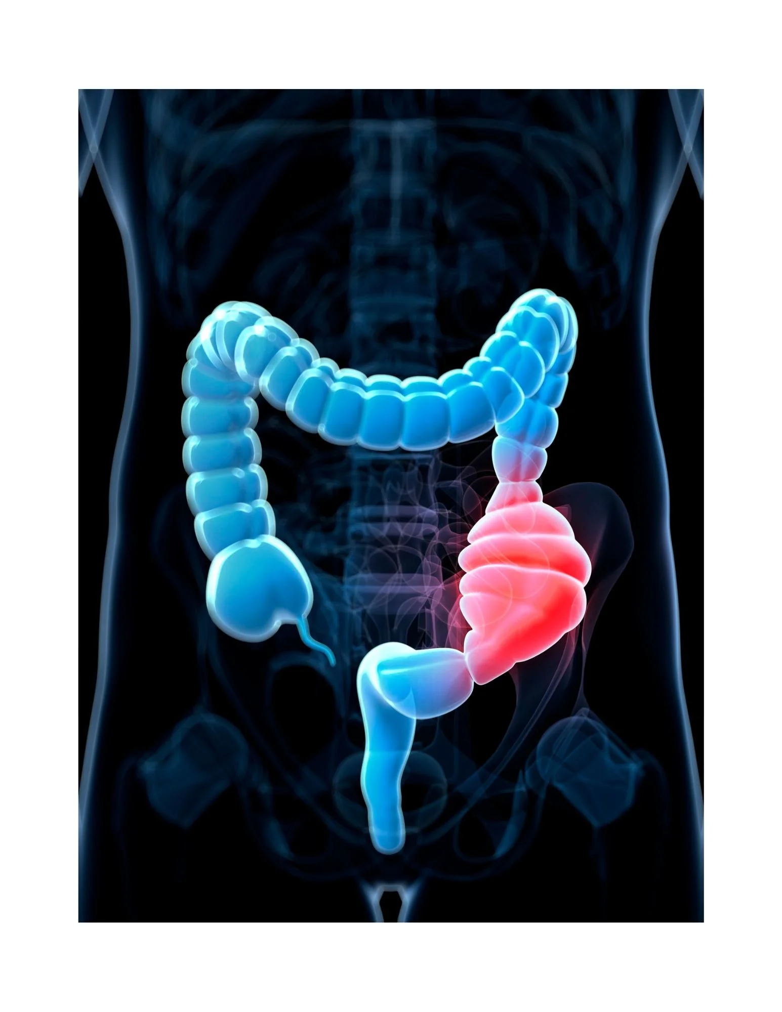 Let’s Talk Constipation