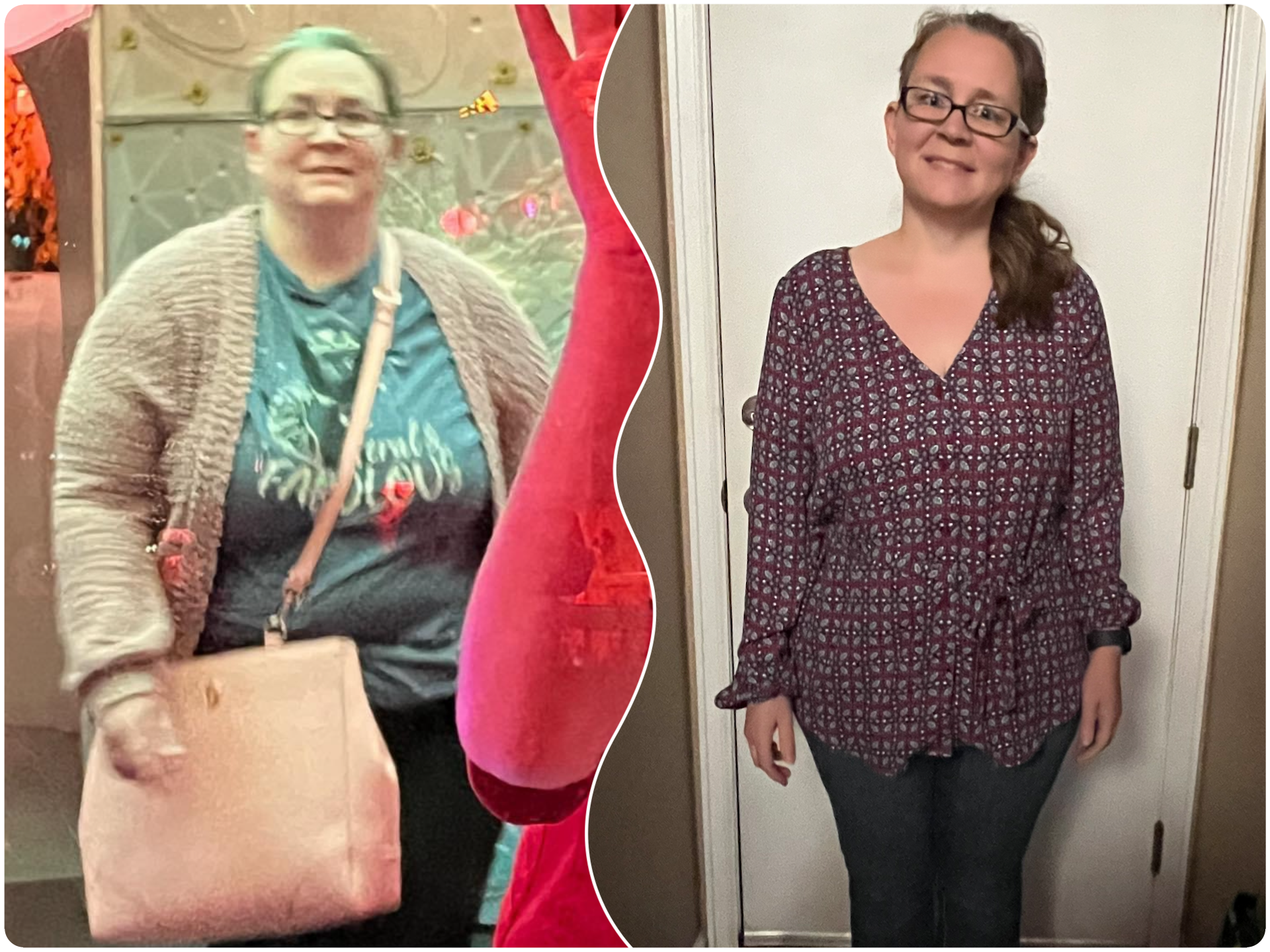 Side-by-side comparison of a woman before and after weight loss.