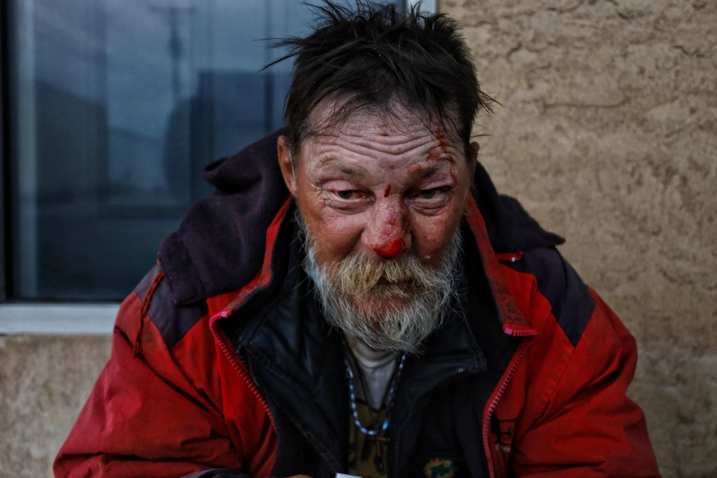 A man with a beard and mustache, face covered in blood, wearing a red and black jacket, sitting outdoors near a window and a concrete wall.