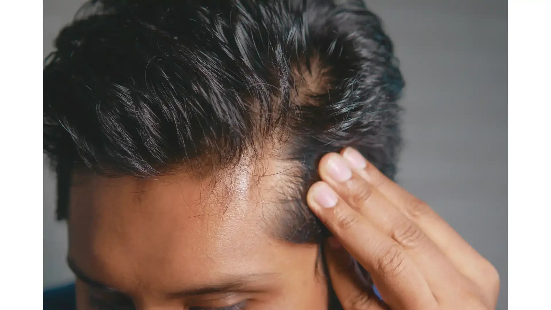 Hair Loss Prevention Made Simple