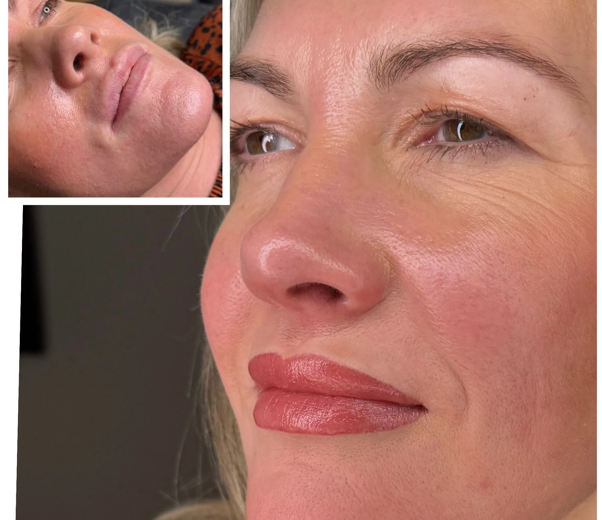 Close-up of a woman's face showing clear, smooth skin and makeup, with an inset of another woman's face with acne and blemishes.