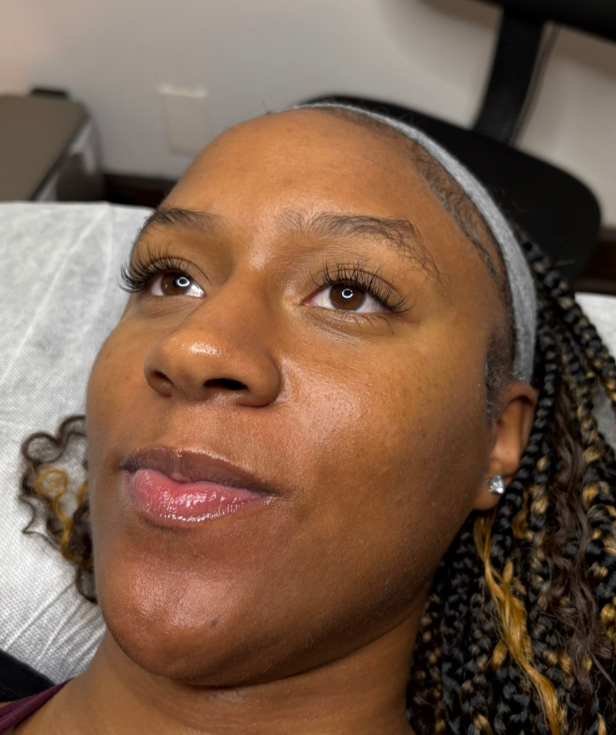 A close-up of a woman lying down on a medical bed, with braided hair, wearing an elastic band around her head, and having a relaxed expression.