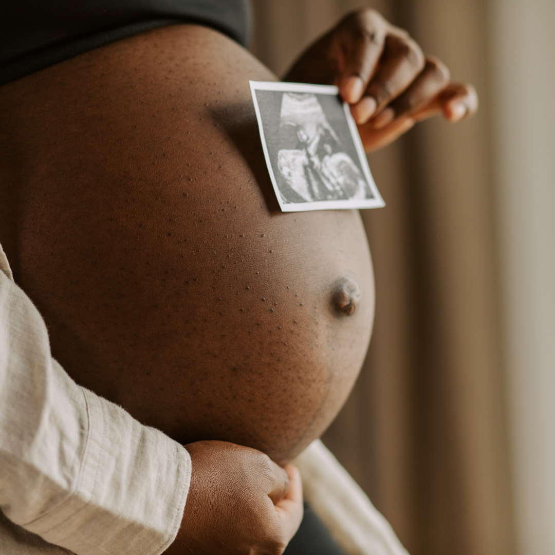 Close-up of a pregnant belly with a hand holding an ultrasound picture against it.