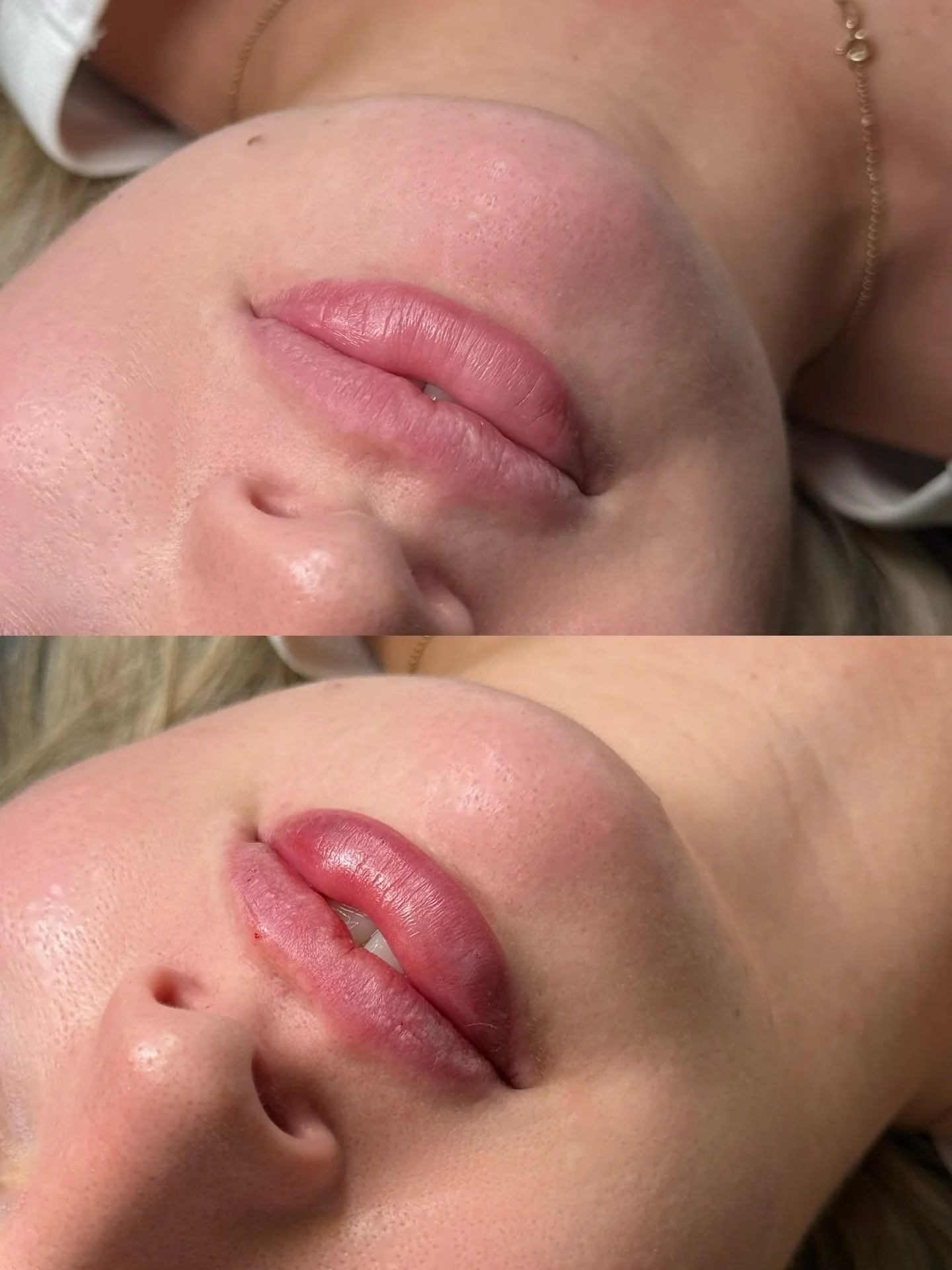 Bringing her lips back to life✨💋

Have you heard the news? I&rsquo;M BACK + 20% OFF FOR YOU💝
Book Now - Fresha link in bio xx