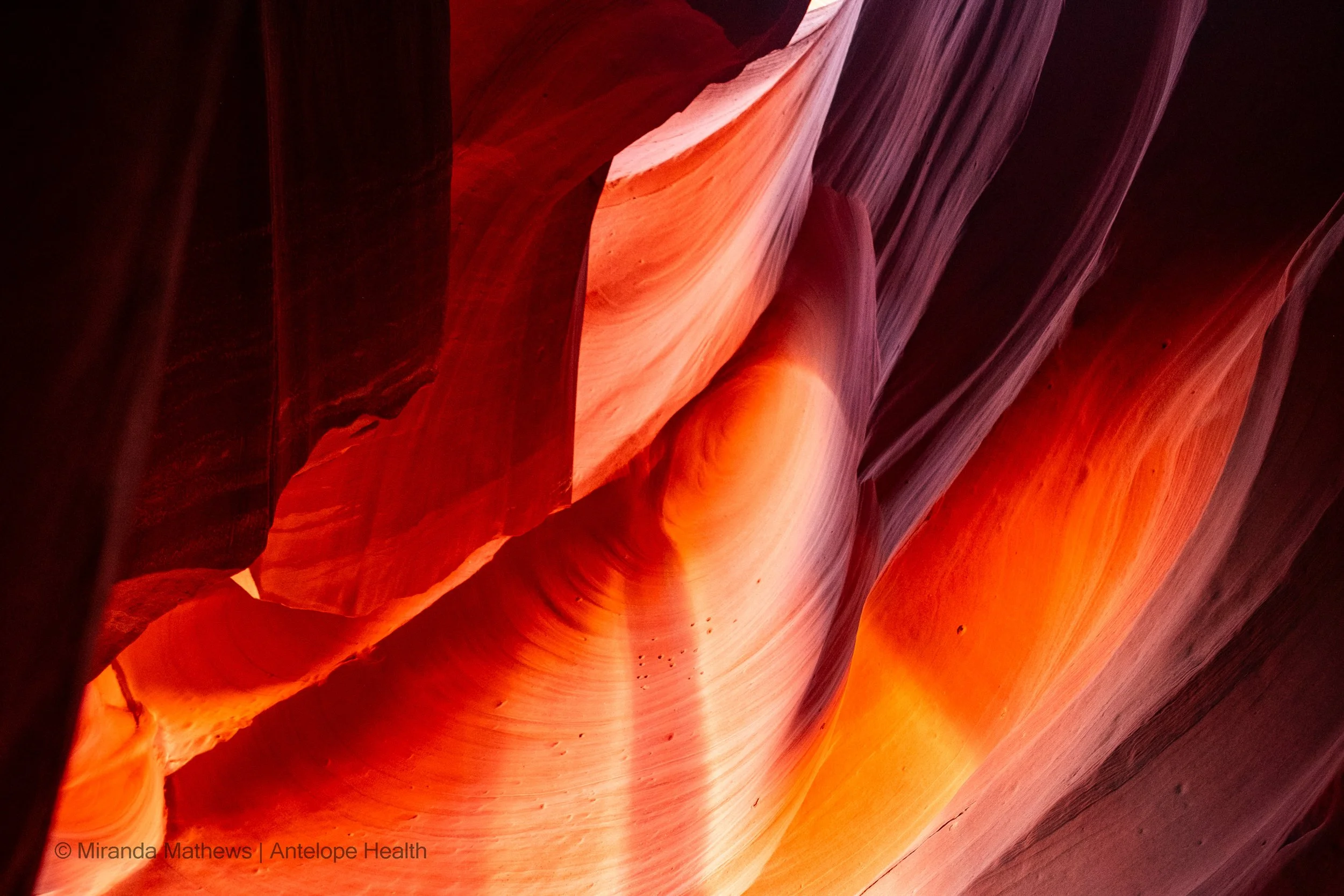 Introducing Antelope Health: A Purpose-First Healthcare Company