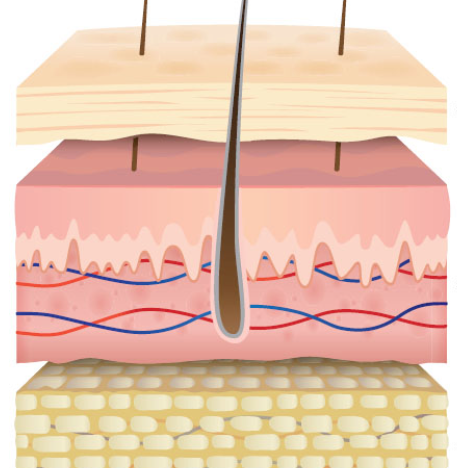 Moisture Damage Pathway