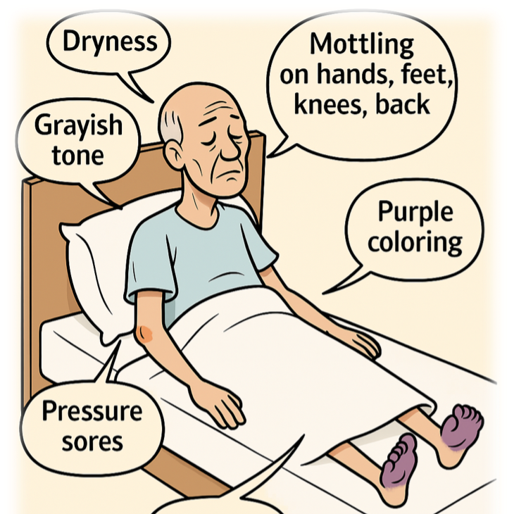 Skin changes at life’s end