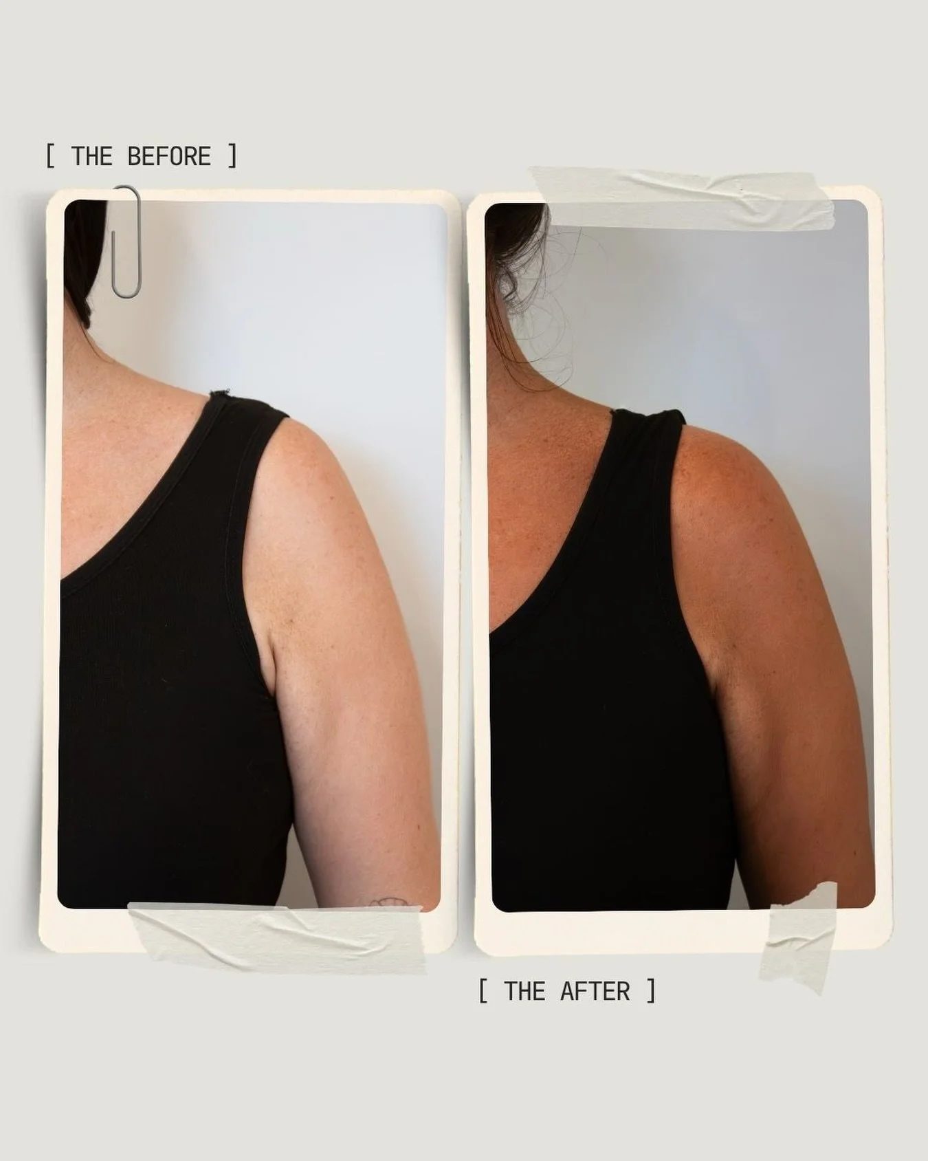 Sun-kissed glow [ - ] the sun damage.

With summer approaching, now&rsquo;s the time to get your tan on but without the harmful effects that come with harsh UV rays. 

Opt for a sun-free tan with the added benefits of&hellip;

[ + ] Color-customizati