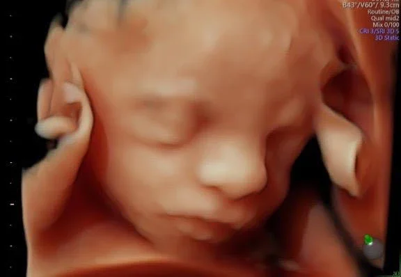 Ultrasound image of a sleeping baby in the womb with a hand gently holding its face.