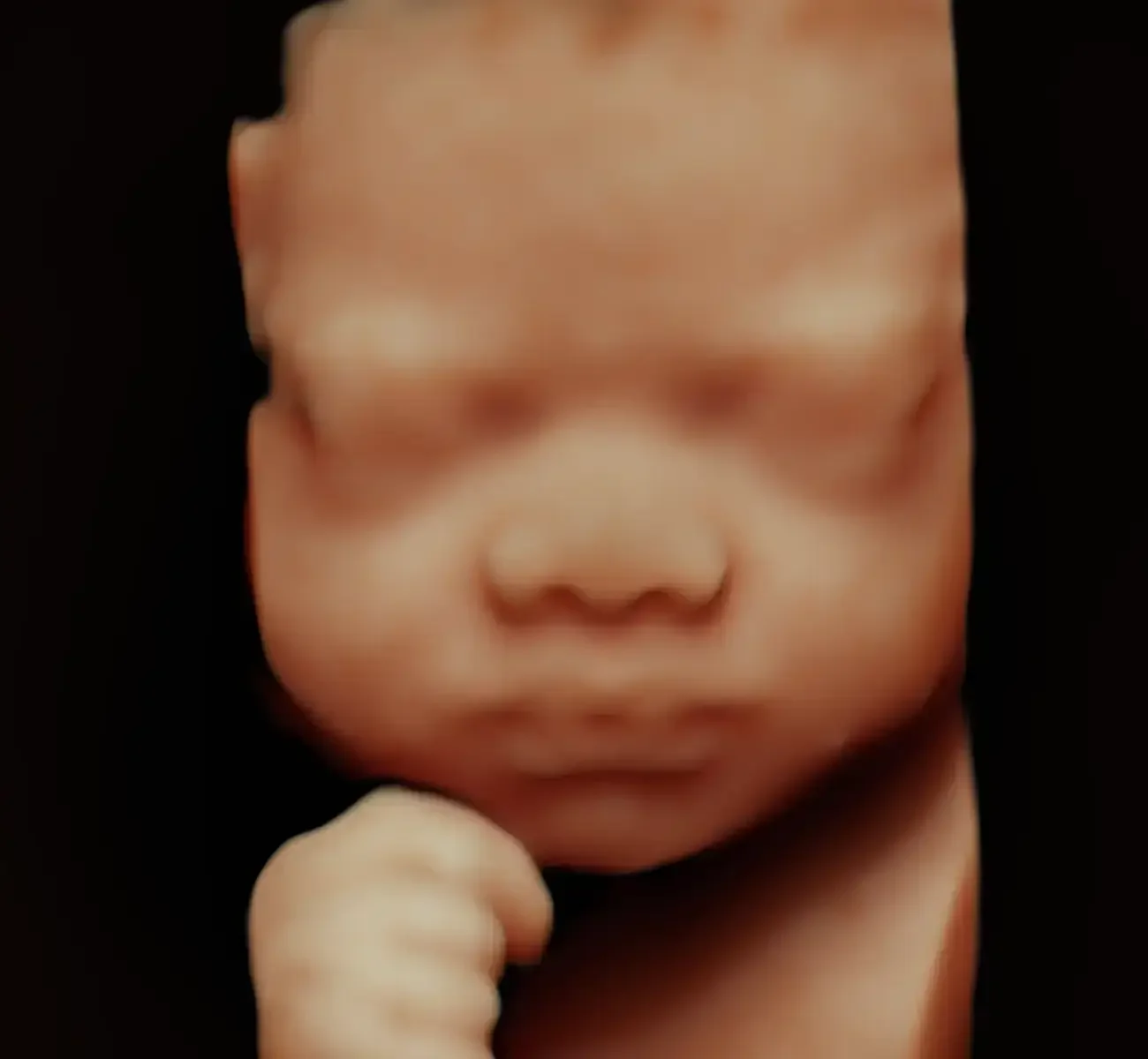 Close-up of a baby with a blurred face and a fist near the chin, against a black background.